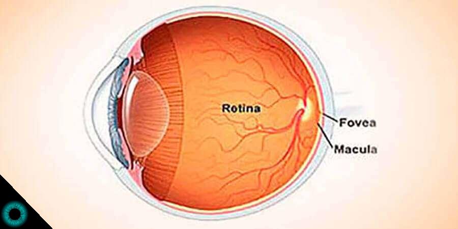 retina hipertenzije)