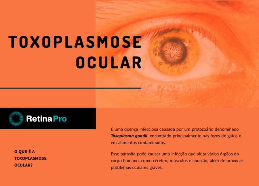 Infográfico - Toxoplasmose Ocular