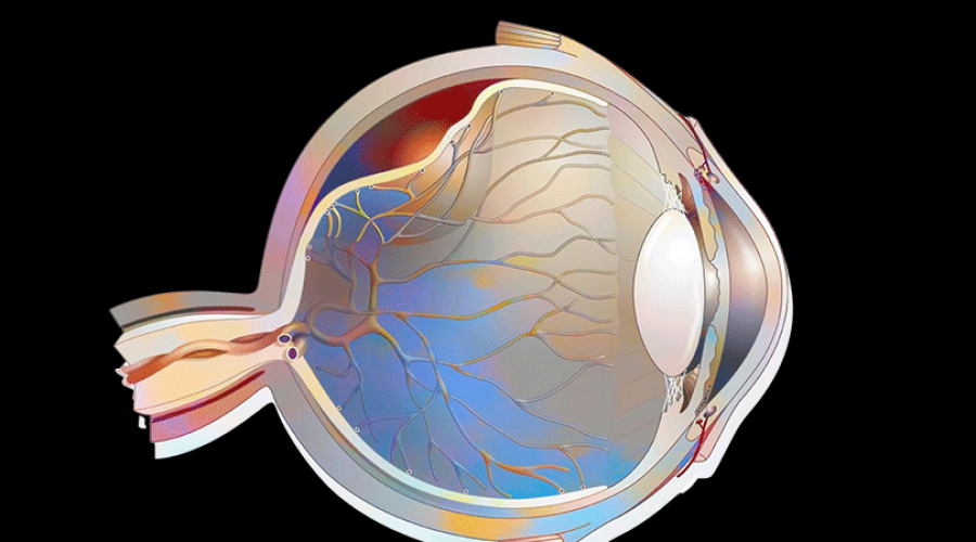 Fique atento aos principais sintomas de descolamento de retina