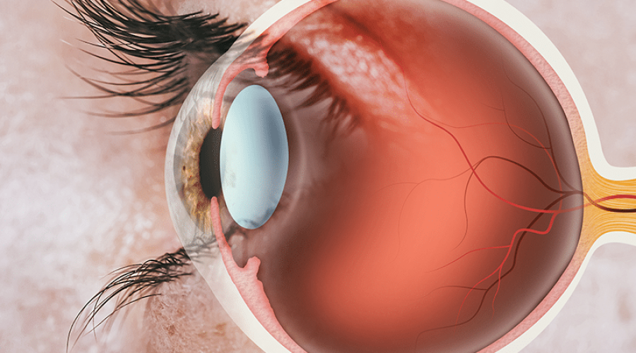 Retina: afinal, o que é essa parte do olho?