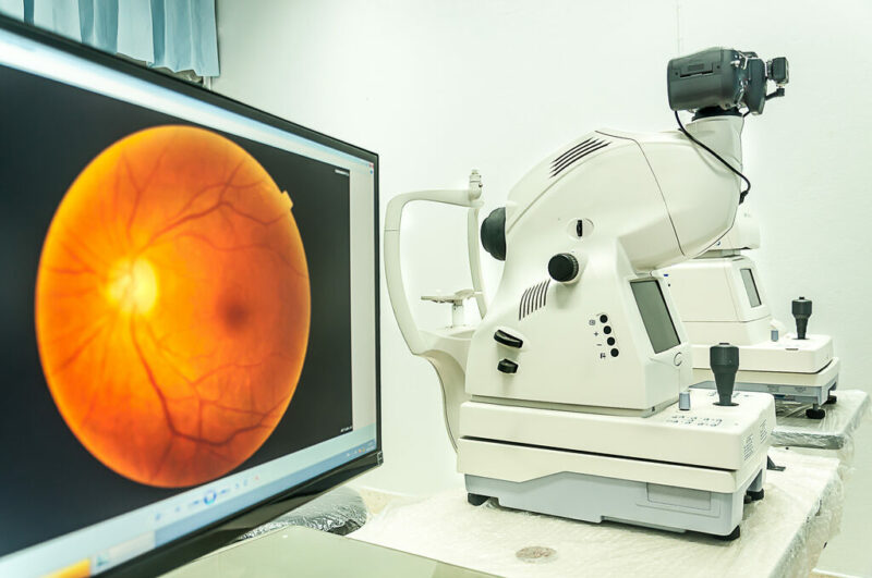 Exame oftalmológico: saiba quais são os exames essenciais para a saúde ocular