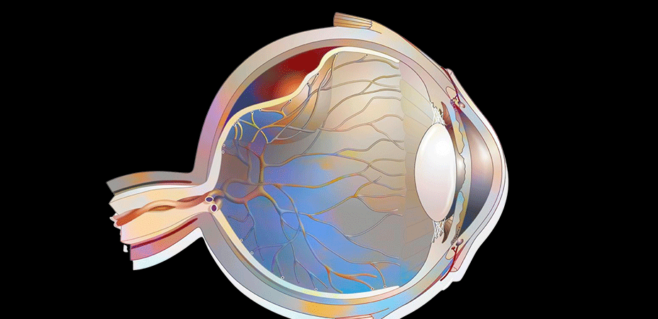 Descolamento de retina: causas, sintomas, tratamentos e recomendações