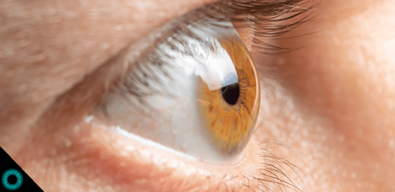 O que é lente intraocular e quando é indicada?