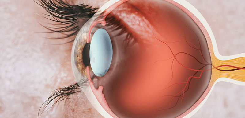 Retina: afinal, o que é essa parte do olho?
